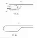 Fig. 03 - Catheter with vessel lining and methods for using same