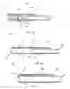 Fig. 04 - Catheter with vessel lining and methods for using same