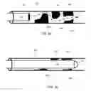 Fig. 05 - Catheter with vessel lining and methods for using same