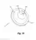Fig. 08 - Apparatus for peripheral vascular access