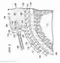 Fig. 03 - Reduced-pressure, wound-closure and treatment systems and methods