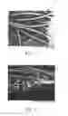 Fig. 10 - Absorbent article with containment barrier