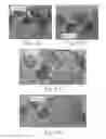 Fig. 32 - Absorbent article with containment barrier