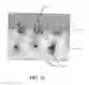 Fig. 09 - Printed nonwoven web and method for making