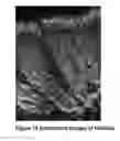 Fig. 16 - Ultrashort Pulse Laser Subsurface Tissue Modifications