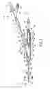 Fig. 03 - Electro-cautery catheter