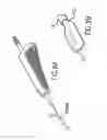 Fig. 07 - Electro-cautery catheter