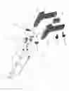 Fig. 04 - Bipolar medical devices for extracting tissue and methods therefor