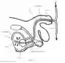 Fig. 28 - Bipolar medical devices for extracting tissue and methods therefor