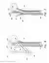 Fig. 06 - APPARATUS FOR TREATING A FRACTURED BONE