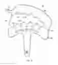 Fig. 05 - CIRCUMCISION CLAMP AND SURGICAL KIT