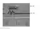 Fig. 08 - SYSTEM AND METHODS FOR HYSTEROSCOPIC TUBULAR LIGATION