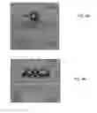 Fig. 09 - SYSTEM AND METHODS FOR HYSTEROSCOPIC TUBULAR LIGATION