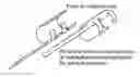 Fig. 01 - Treatment of sphincter dysfunction
