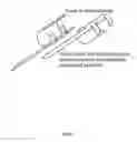 Fig. 02 - Treatment of sphincter dysfunction