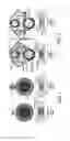 Fig. 08 - Treatment of sphincter dysfunction