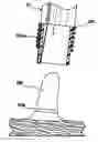 Fig. 01 - Endoscopic apparatus with integrated variceal ligation device