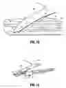 Fig. 09 - Suturing device with deployable needle