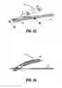 Fig. 10 - Suturing device with deployable needle