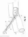 Fig. 09 - VASCULAR SUTURING DEVICE WITH NEEDLE CAPTURE