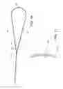 Fig. 06 - Acromioclavicular joint fixation using suture button contstruct with dog bone-shaped button