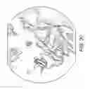 Fig. 09 - Acromioclavicular joint fixation using suture button contstruct with dog bone-shaped button