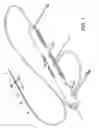 Fig. 02 - Rotational device with eccentric abrasive element and method of use
