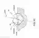 Fig. 06 - Ribbed surgical bur