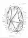 Fig. 02 - MEDICAL DEVICE FOR OCCLUDING A HEART DEFECT AND A METHOD OF MANUFACTURING THE SAME