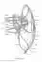 Fig. 06 - MEDICAL DEVICE FOR OCCLUDING A HEART DEFECT AND A METHOD OF MANUFACTURING THE SAME