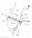 Fig. 01 - Systems and Methods for Treating Septal Defects