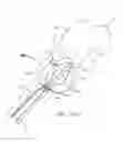 Fig. 22 - Systems and Methods for Treating Septal Defects