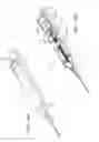 Fig. 65 - Systems and Methods for Treating Septal Defects