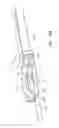 Fig. 76 - Systems and Methods for Treating Septal Defects