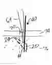 Fig. 01 - Apparatus and method for anchoring sutures