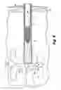 Fig. 07 - Interspinous process implants having deployable engagement arms