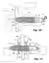 Fig. 08 - Interspinous process implants having deployable engagement arms