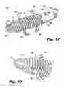 Fig. 09 - Interspinous process implants having deployable engagement arms