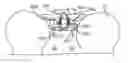 Fig. 01 - Sacral tether anchor and methods of use