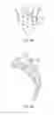 Fig. 07 - Sacral tether anchor and methods of use