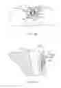 Fig. 13 - Sacral tether anchor and methods of use