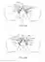 Fig. 17 - Sacral tether anchor and methods of use