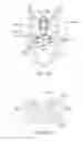 Fig. 29 - Sacral tether anchor and methods of use