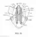 Fig. 31 - Sacral tether anchor and methods of use