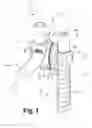 Fig. 02 - Friction set screw for use with spinal implant systems