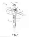 Fig. 04 - Friction set screw for use with spinal implant systems