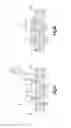 Fig. 02 - Method of fixating two or more anatomical bodies