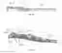 Fig. 41 - Method and apparatus for attaching soft tissue to bone