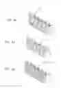 Fig. 09 - Faceted bone screw