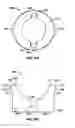 Fig. 11 - Fixation screw assembly